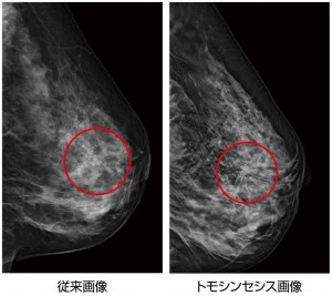 従来画像との比較