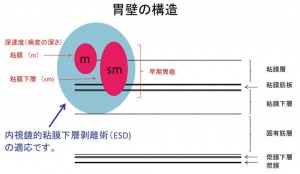 胃壁の構造